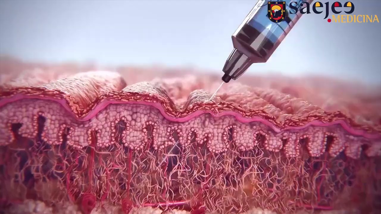 Programme de spécialisation en dermatologie et vénérologie