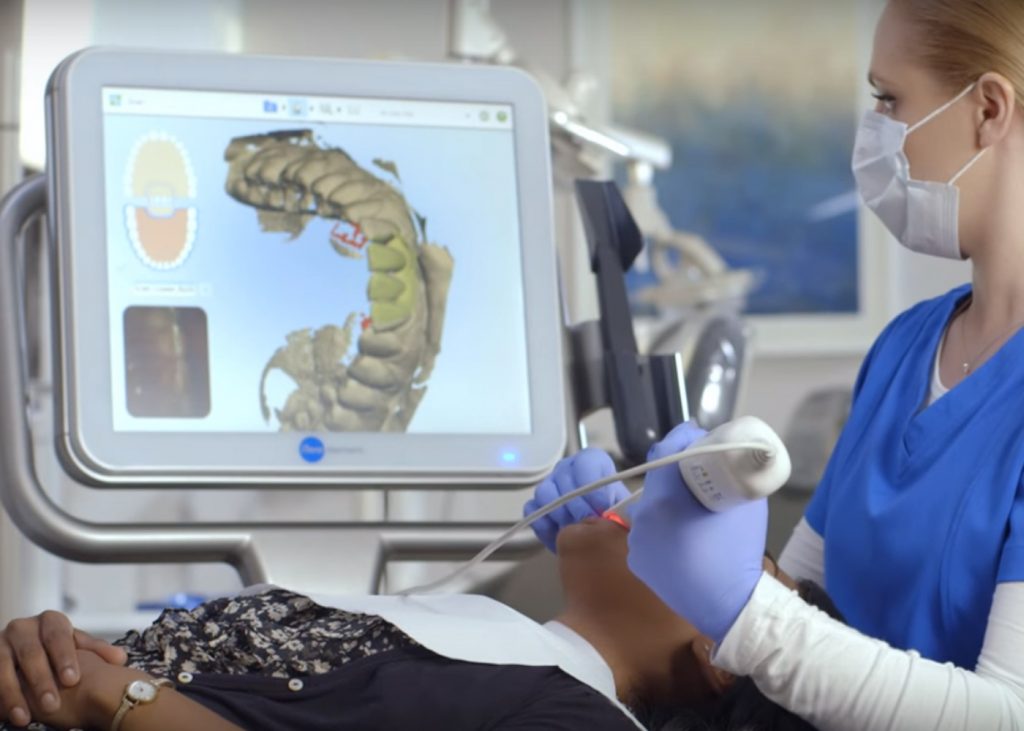 Ortodoncista realizando escaneo intraoral 3D con iTero - Especialización Ortodoncia Digital