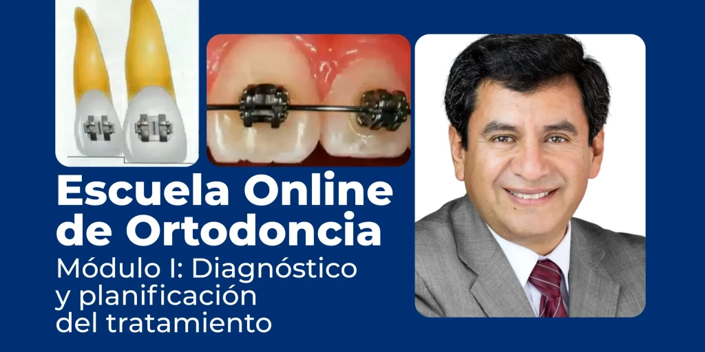 Clase en vivo de ortodoncia digital por Zoom con profesores en activo